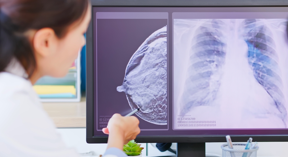 Mammography on two computer screens and female doctor